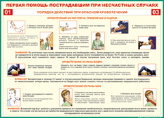 Таблица "Порядок действий при опасном кровотечении" (100х140 сантиметров, винил) - fgospostavki.ru - Смоленск